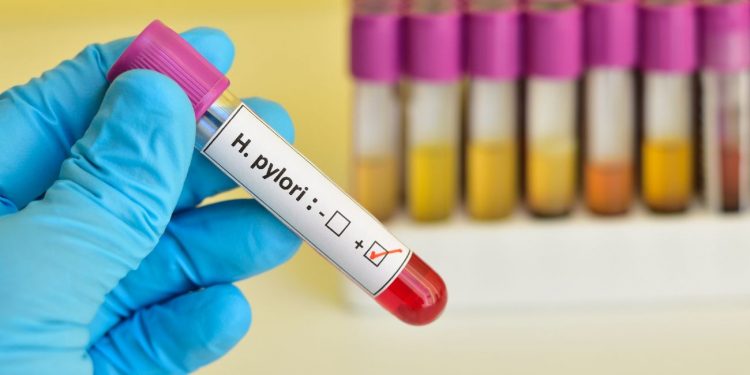 Infezione da Helicobacter Pylori