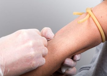 L’orrenda Storia della nascita degli accessi venosi