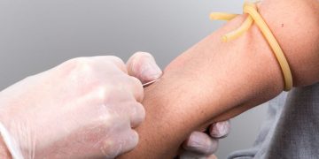 L’orrenda Storia della nascita degli accessi venosi