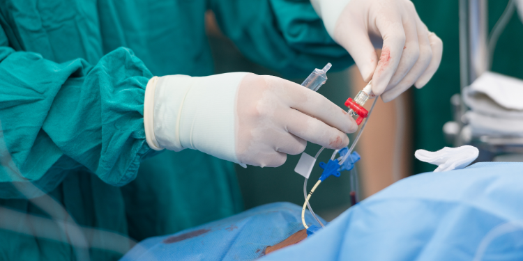 Il Catetere di Swan-Ganz: Definizione, Metodo d’Uso e Gestione Infermieristica