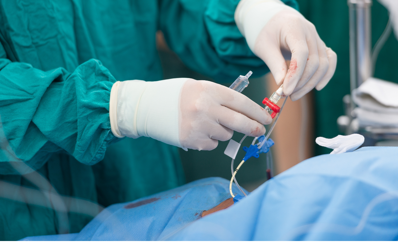 <strong>Il Catetere di Swan-Ganz: Definizione, Metodo d’Uso e Gestione Infermieristica</strong>