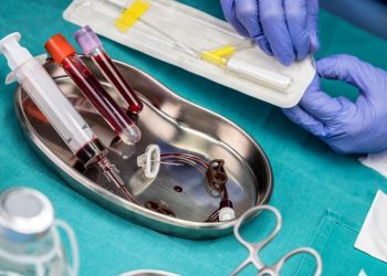 La valutazione del patrimonio venoso