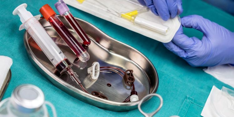 La valutazione del patrimonio venoso